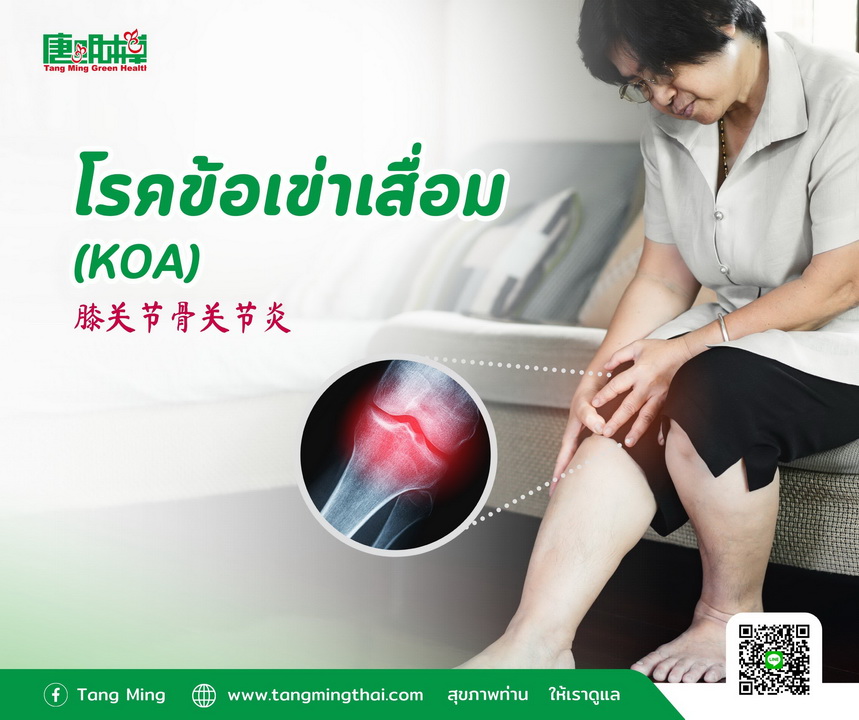 โรคข้อเข่าเสื่อม (KOA) 膝关节骨关节炎
